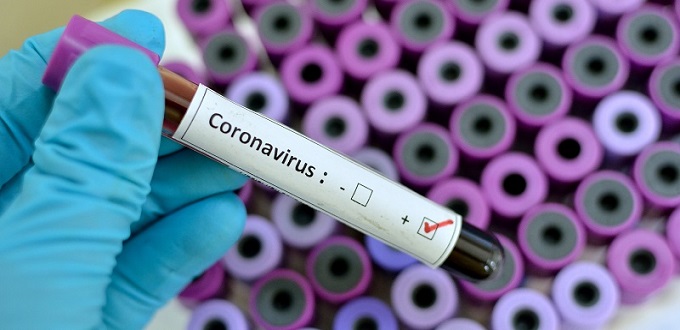 Coronavirus : l’OMS renforce les dispositifs de dépistage
