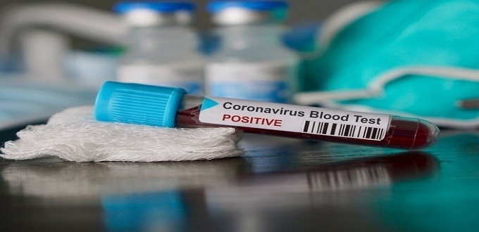 Le Maroc enregistre son 3ème cas de Coronavirus