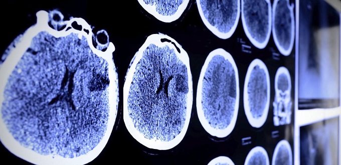 Une application pour détecter le coronavirus en quelques secondes