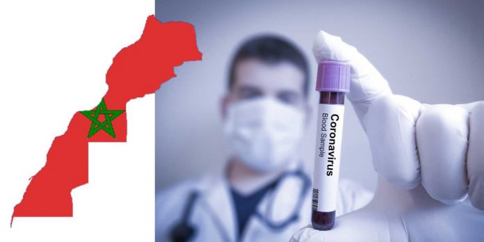 Coronavirus : 21 nouveaux cas confirmés, 7 nouvelles guérisons