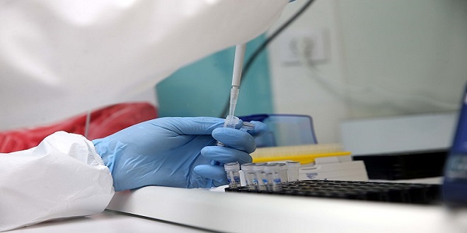 Covid-19: le ministère de la Santé dément l'acquisition de tests de dépistage périmés