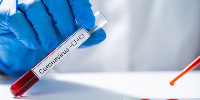 Coronavirus: plus d'un million de tests réalisés au Maroc