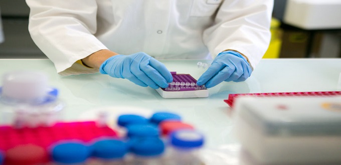 Le Maroc et six  pays africains vont commencer à tester les anticorps Covid-19