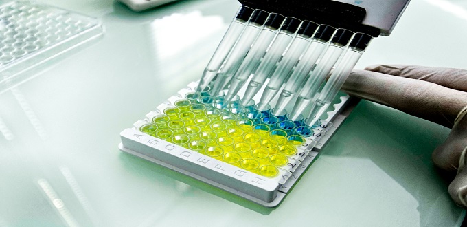 Covid-19 : Publication d’une étude marocaine sur la détection des anticorps